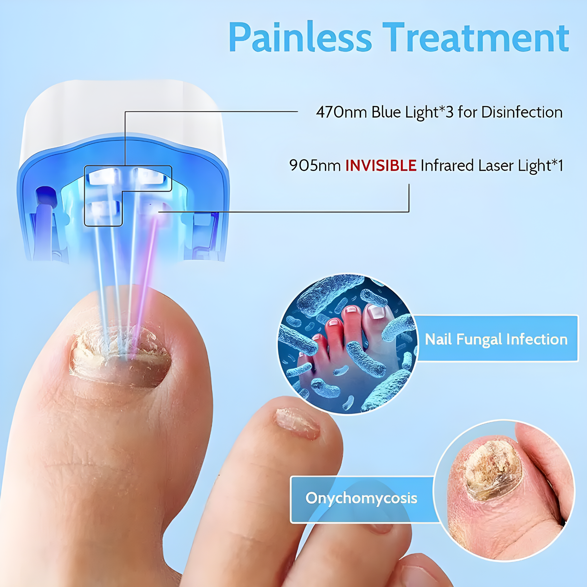 ClearNail Laser